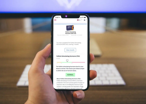 Follicle Stimulating Hormone (FSH) Test