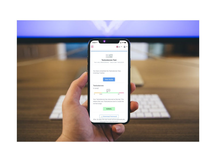 Testosterone Test
