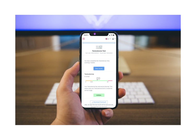 Testosterone Test