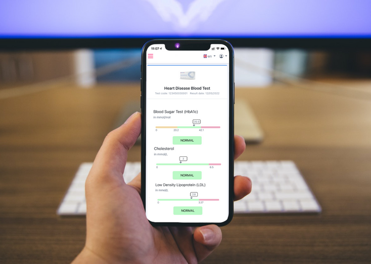 Heart Disease Blood Test