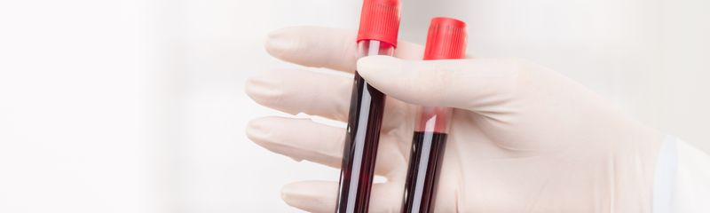 Haemoglobin: what a low haemoglobin level can mean for your health