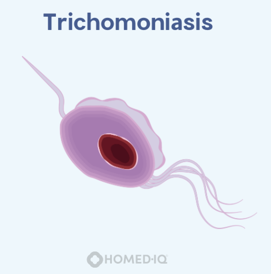 Trichomoniasis en Bacteriële Vaginose: Belangrijke Verschillen die je Moet Weten - Homed-IQ