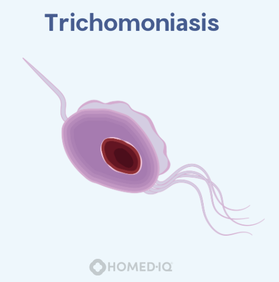 Trichomoniasis und Bakterielle Vaginose: Wichtige Unterschiede, die Sie kennen sollten - Homed-IQ